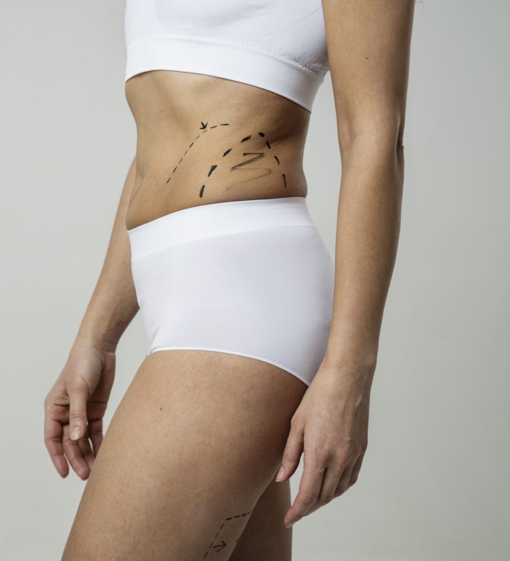 side-view-woman-with-marker-traces-skin-scaled.jpg